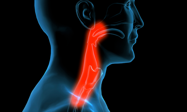 cuello